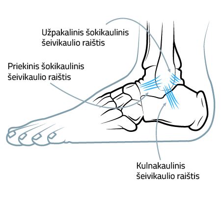 Čiurnos raiščių patempimas