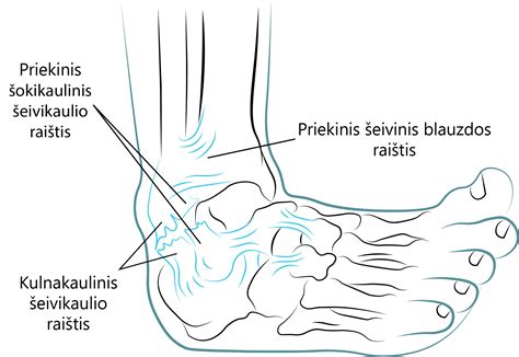 Čiurnos raiščių plyšimas