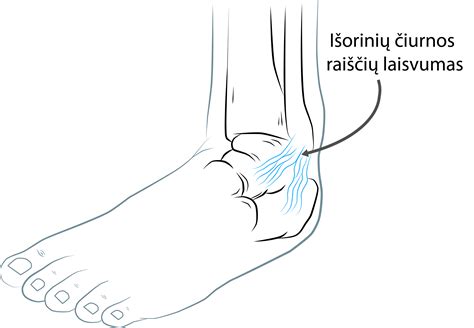 Čiurnos sąnario schema