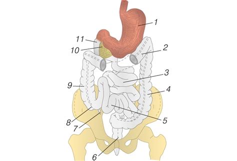 Žarnyno nepraeinamumo schema