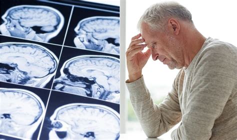 Alzheimerio ligos statistika