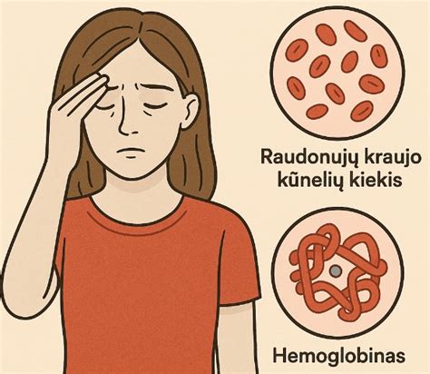 Anemijos simptomai