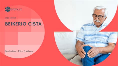 Beikerio cistos simptomai