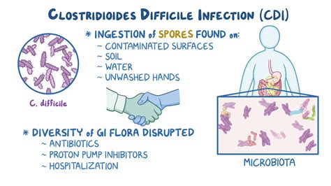 Clostridium Difficile Infekcijos Schema