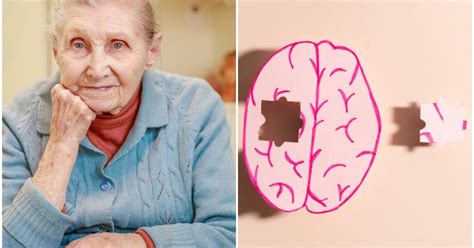 Demencija ir Reabilitacija