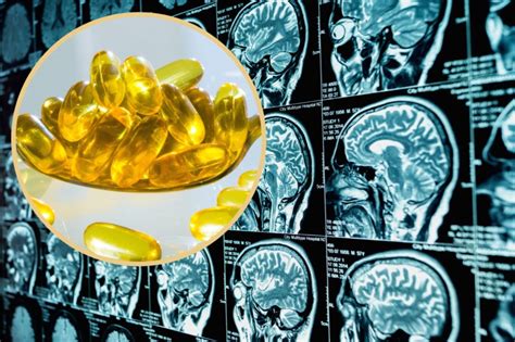 Demencijos rizikos veiksniai