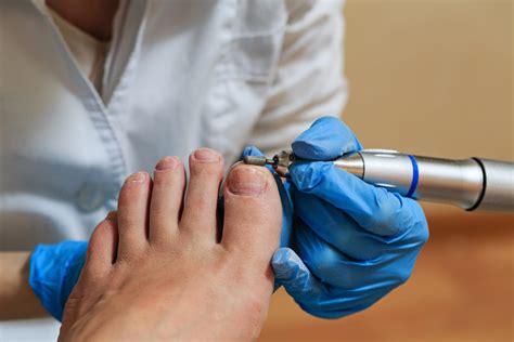 Diabetinės pėdos priežiūra