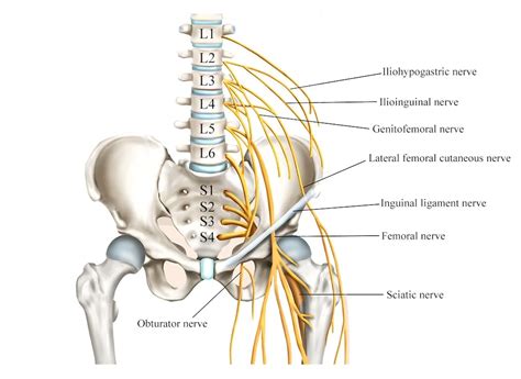 Juosmens radikulopatija