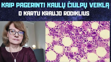 Kaulų čiulpų transplantacijos procesas