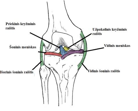 Kelio sąnario endoprotezavimo schema