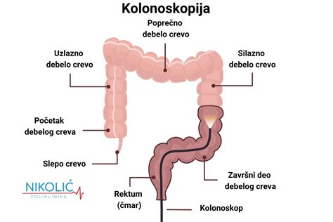 Kolonoskopija