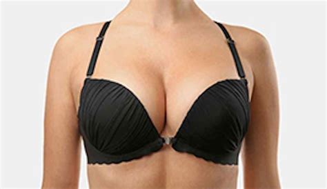 Krūtų didinimas prieš ir po