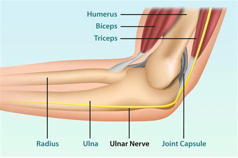Kubitalinio kanalo sindromas