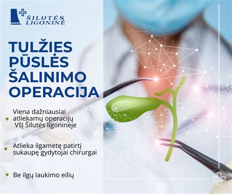 Laparoskopinė tulžies pūslės šalinimo operacija