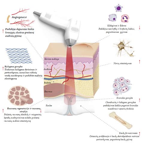Lazerinė terapija priklausomybių gydyme
