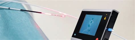 Lazerinė venų operacija