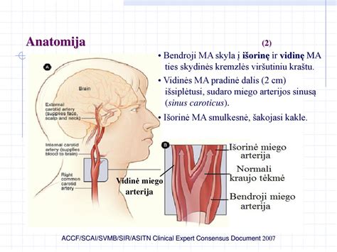 Miego arterijos schema