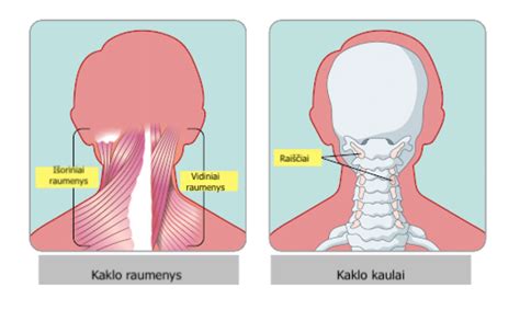 Minkštųjų audinių sarkomos simptomai