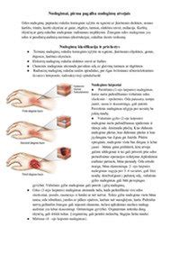 Nudegimų klasifikacija