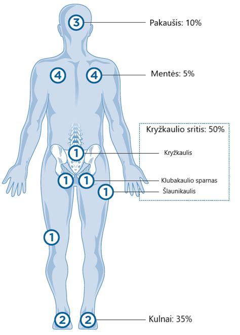 Pragulos susidarymo vietos