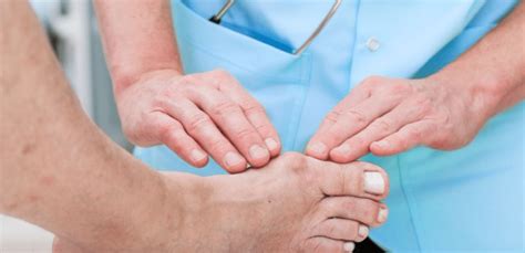 Reabilitacija po Hallux Valgus operacijos