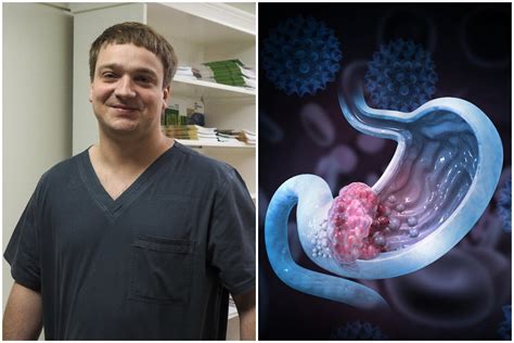 Skrandžio vėžio gydymas