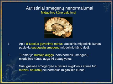Smegenų skirtumai autizmo atveju