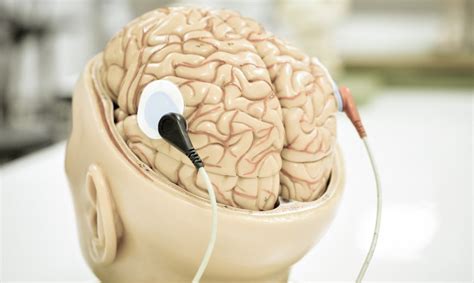 Smegenų stimuliacija