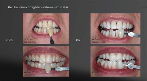 Tvarūs rezultatai po reabilitacijos