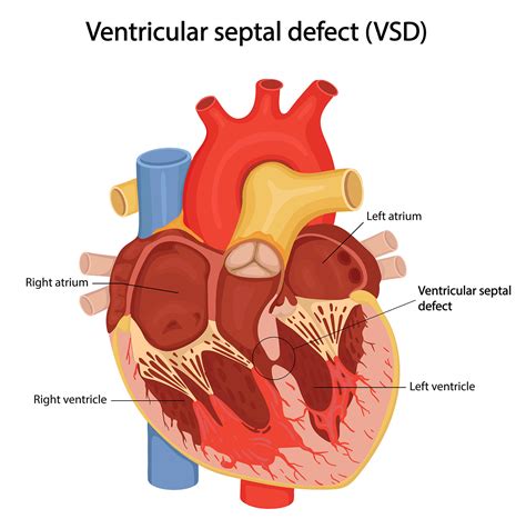 VSD įmokų skaičiuoklė