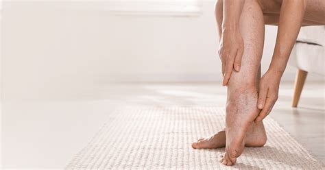 Venų varikozės stadijos